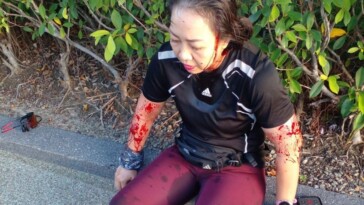 jogger-left-bloodied,-dazed-and-crying-after-getting-mauled-—-by-a-gang-of-otters