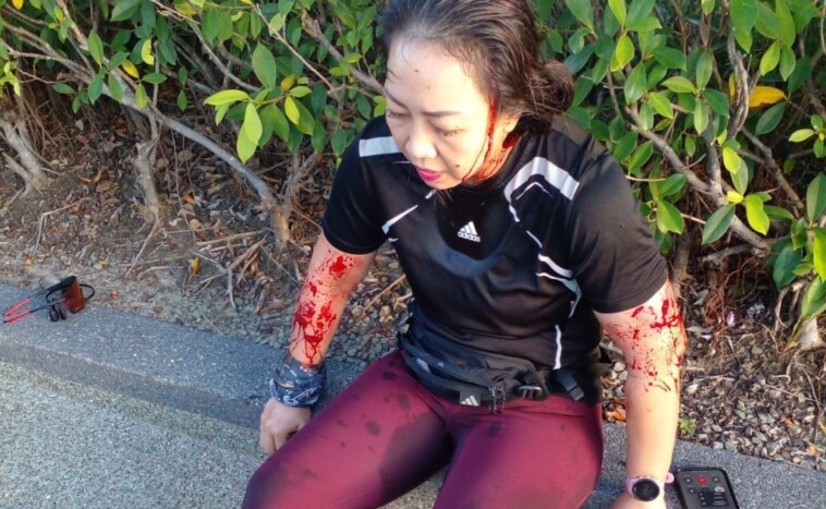 jogger-left-bloodied,-dazed-and-crying-after-getting-mauled-—-by-a-gang-of-otters