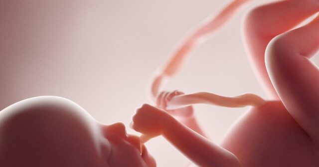 media-admit-babies-are-aborted-weeks-before-birth-because-they-are-‘unwanted’