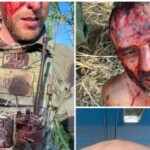 migrant-punches,-bites-border-patrol-agent’s-face-in-new-mexico