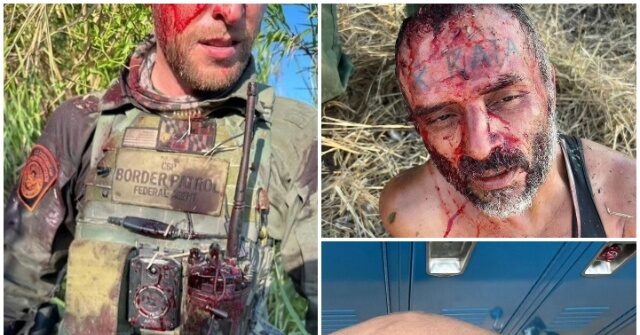 migrant-punches,-bites-border-patrol-agent’s-face-in-new-mexico