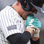 yankees’-anthony-rizzo-fractures-fingers-after-being-hit-by-pitch,-not-yet-ruled-out-for-playoffs