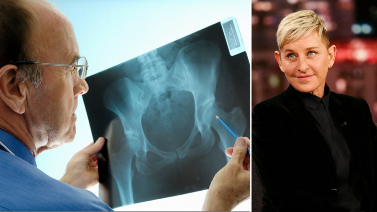 ellen-degeneres-has-osteoporosis:-here’s-what-to-know-about-the-painful-bone-condition