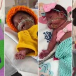 see-nicu-babies-in-adorable-costumes-for-their-first-halloween