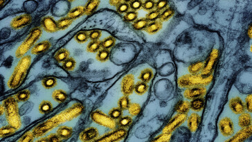 canadian-teen-hospitalized-in-critical-condition-with-deadly-bird-flu