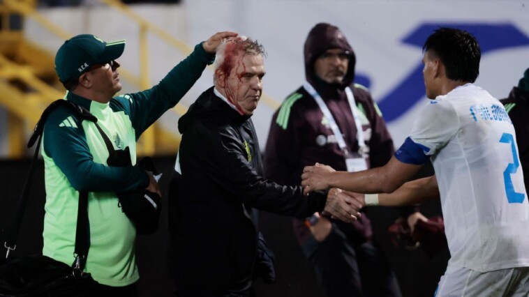 mexico-coach-hit-in-head-by-beer-can-in-honduras