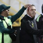 mexico-soccer-coach-javier-aguirre-injured-after-being-hit-in-head-by-apparent-beer-can-that-was-thrown-from-the-stands