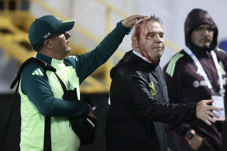 mexico-soccer-coach-javier-aguirre-injured-after-being-hit-in-head-by-apparent-beer-can-that-was-thrown-from-the-stands