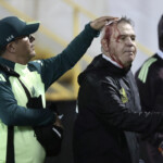 mexico-manager-javier-aguirre-bloodied-after-being-hit-with-beer-can-following-loss-to-honduras