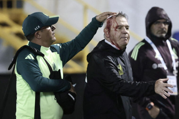 mexico-manager-javier-aguirre-bloodied-after-being-hit-with-beer-can-following-loss-to-honduras