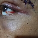 female-rikers-officer-punched-in-the-face-by-hulking-inmate-—-wants-nyc-to-reinstate-solitary-confinement