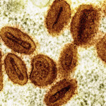 us-health-officials-report-first-known-case-of-new,-more-severe-strain-of-monkeypox