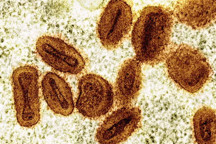 us-health-officials-report-first-known-case-of-new,-more-severe-strain-of-monkeypox