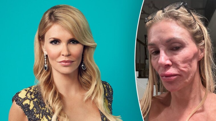 brandi-glanville-shares-stripped-down-photo-as-she-claims-her-‘looks-are-ruined’-by-mystery-illness