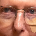 mitch-mcconnell-appears-bruised,-bandaged-after-latest-fall-at-capitol