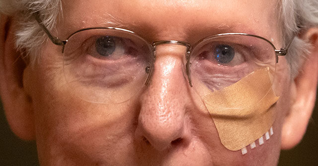 mitch-mcconnell-appears-bruised,-bandaged-after-latest-fall-at-capitol