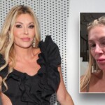 brandi-glanville-spending-‘all-of-my-money’-looking-for-answers-to-mystery-illness-that-left-her-disfigured