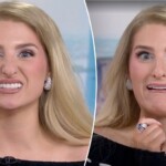 meghan-trainor-said-‘nobody-warned-me’-before-she-went-too-far-with-botox