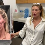 brandi-glanville-thinks-parasite-attacked-face-as-‘botched’-doc-terry-dubrow-calls-her-‘ticking-time-bomb’