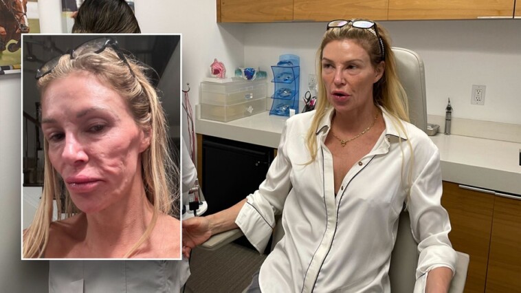 brandi-glanville-thinks-parasite-attacked-face-as-‘botched’-doc-terry-dubrow-calls-her-‘ticking-time-bomb’