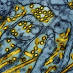 first-severe-bird-flu-case-in-the-us-found-in-louisiana-patient,-health-officials-say