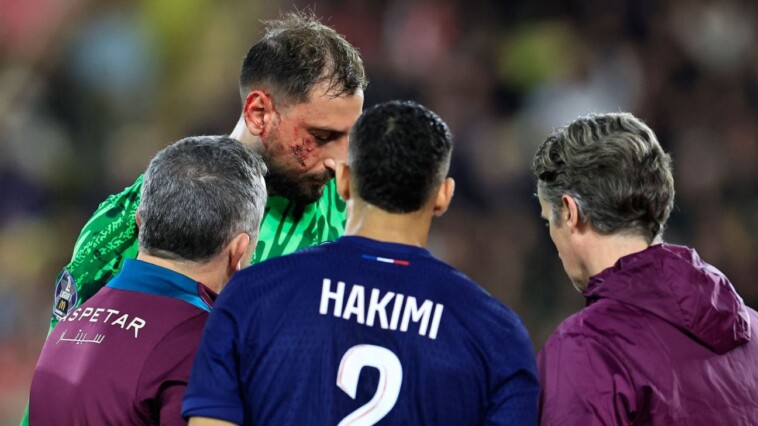 psg-keeper-donnarumma-injured-by-cleat-to-face