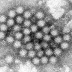 norovirus-cases-are-surging-in-parts-of-the-us,-cdc-data-shows