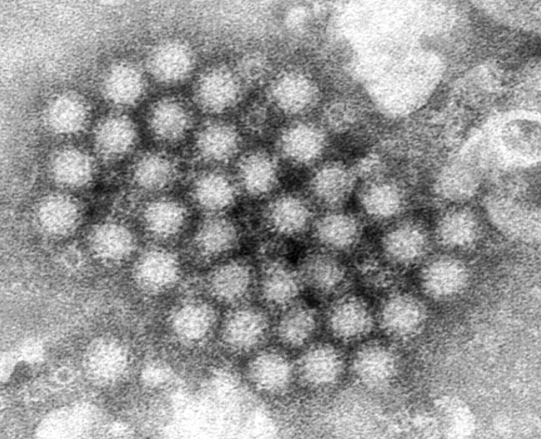 norovirus-cases-are-surging-in-parts-of-the-us,-cdc-data-shows