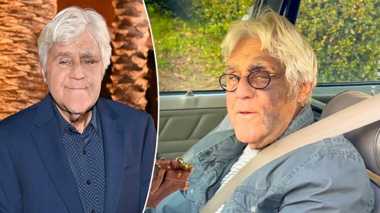 jay-leno-addresses-rumors-his-facial-injuries-were-related-to-mob-retaliation