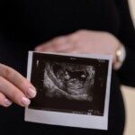 abortion-was-leading-global-cause-of-death-in-2024-with-over-45-million-killed