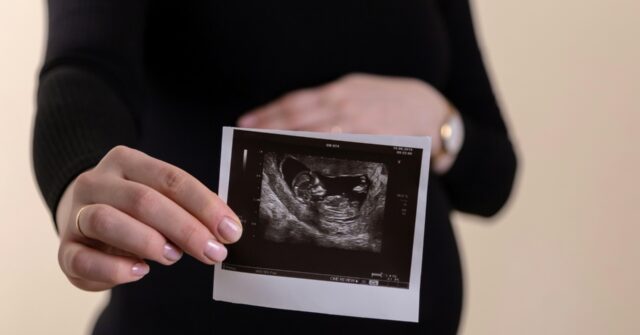 abortion-was-leading-global-cause-of-death-in-2024-with-over-45-million-killed