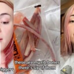 gross:-transgender-tiktoker-spends-$17,000-to-remove-six-of-his-ribs-—-plans-to-make-them-into-a-crown-(video)