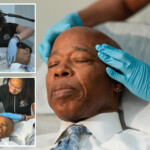 mayor-eric-adams-gets-laser-hair-removal-while-touting-$85m-investment-in-nyc-small-businesses