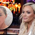 ‘real-housewives’-star-teddi-mellencamp’s-brain-surgery-removed-more-tumors-than-expected