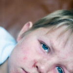 measles-cases-reported-in-kentucky,-new-jersey-as-texas-battles-outbreak