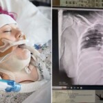 ‘i-vaped-for-one-year-and-almost-died’