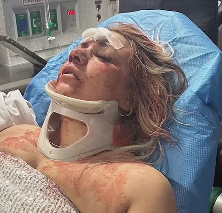 ex-con-allegedly-attacks-bride-to-be-at-texas-bachelorette-party-—-leaving-her-unconscious
