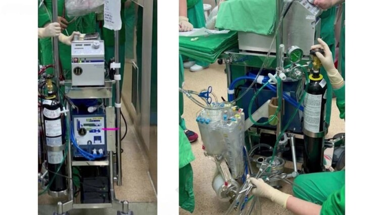world’s-first-continuous-beating-heart-transplant