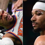 knicks’-josh-hart-suffers-bloody-cut-over-eye-in-team’s-loss-to-celtics