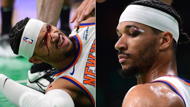 knicks’-josh-hart-suffers-bloody-cut-over-eye-in-team’s-loss-to-celtics
