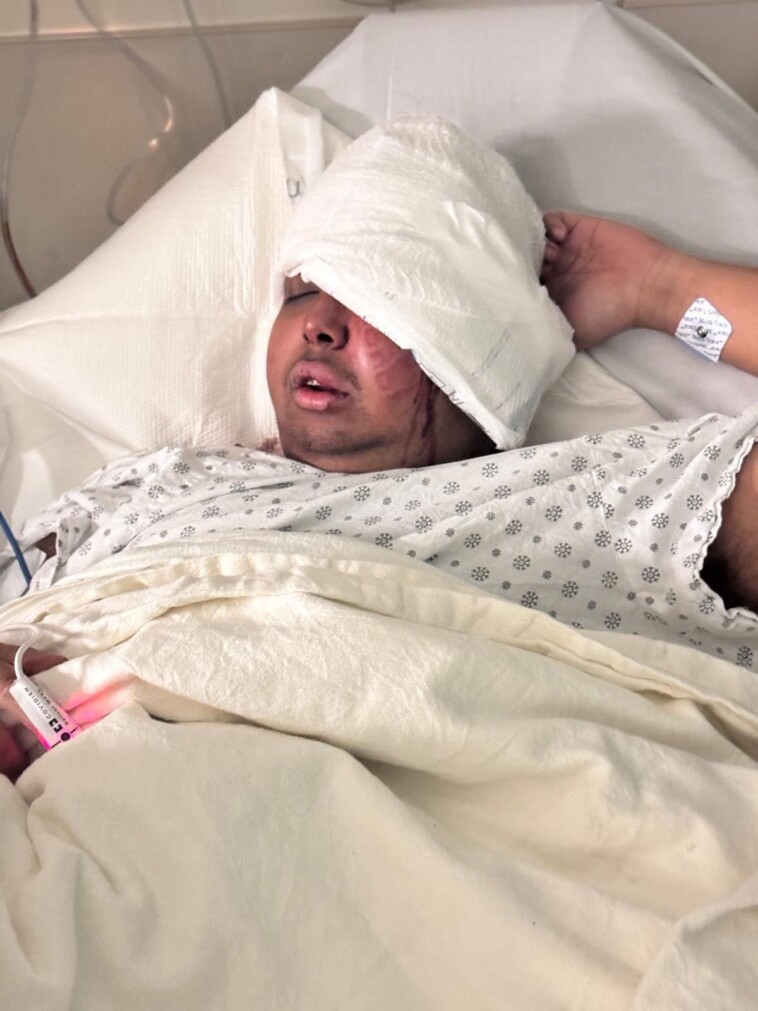 masked-thugs-brutally-beat,-rob-uniformed-nypd-cop-in-brazen-attack