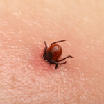 potentially-deadly-bacteria-found-in-invasive-tick-for-first-time-in-us