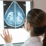 fda-approves-first-ai-tool-to-predict-breast-cancer-risk