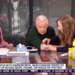tv-host-discovers-he-has-skin-cancer-during-live-on-air-broadcast