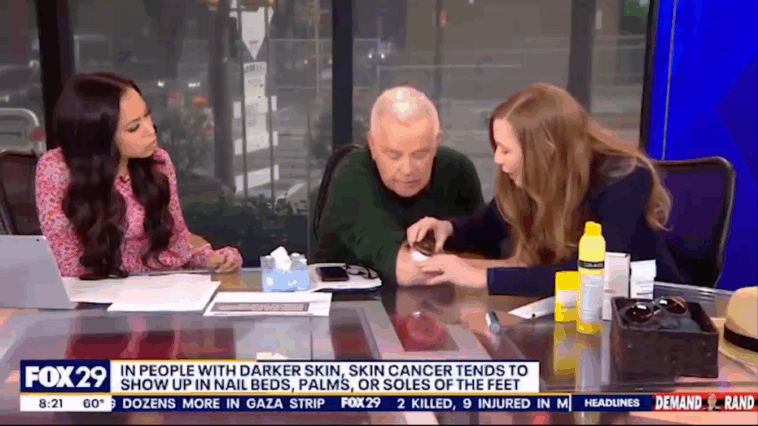 tv-host-discovers-he-has-skin-cancer-during-live-on-air-broadcast