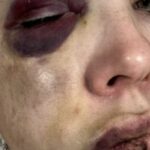 senator-bernie-moreno-releases-horrific-photos-of-cincinnati-mob-beating-victim