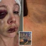 gruesome-photos-show-severely-battered-face-of-the-woman-knocked-out-during-horrifying-cincinnati-brawl