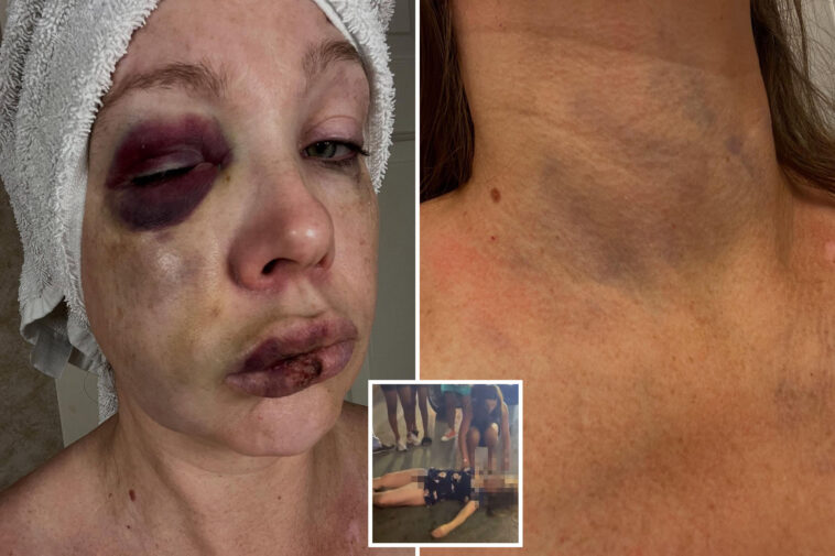 gruesome-photos-show-severely-battered-face-of-the-woman-knocked-out-during-horrifying-cincinnati-brawl