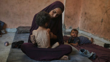 horrifying-photos-show-starving-kids-in-gaza-—-as-hamas-made-mockery-of-cease-fire-talks-with-israel