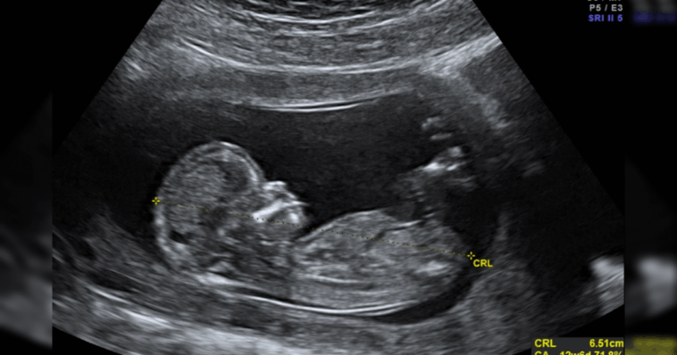texas-father-sues-california-doctor-for-wrongful-death-of-his-unborn-children-in-landmark-abortion-pill-case